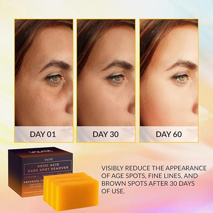 Valitic Unisex Dark Spot Corrector Bar, 100g - Exfoliating, SLS and Paraben-Free Turmeric Soap for Skin Tone Correction, Vitamin C, Retinol and Collagen Blend