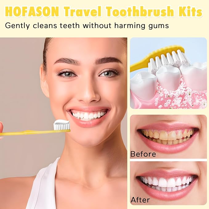 HOFASON Disposable Toothbrushes with Toothpaste Pack of 30, Yellow Hollow Travel Toothbrush Set with 5g Toothpaste Individually Wrapped Toothpaste Bulk for Homeless, Nursing Home, Shelter, Hotel